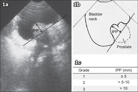 Singapore Urological Association Clinical Guidelines For Male Lower