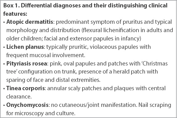 management of psoriasis in primary care